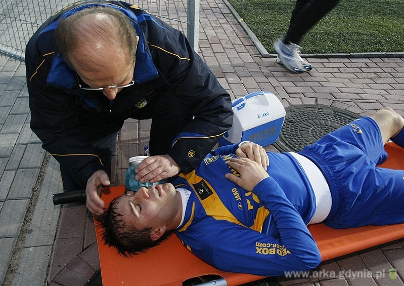 Glavina ze złamaną kością jarzmową